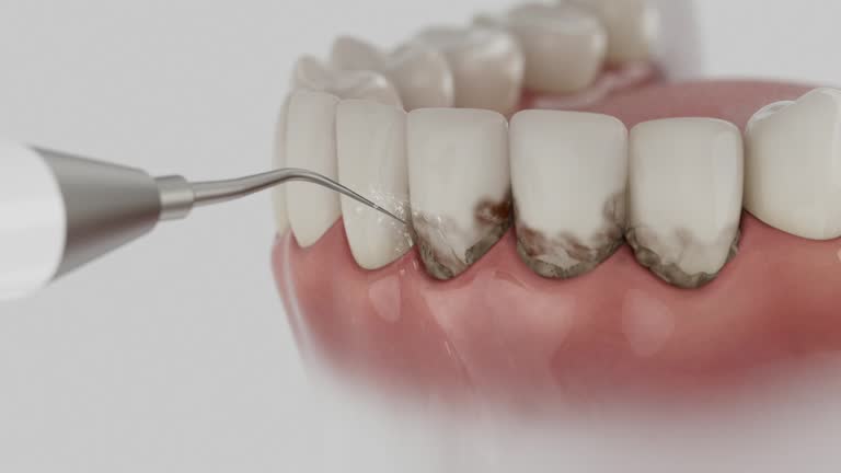Trusted Root Canal Treatment service in Hamilton Square, NJ - Dentist Open Now